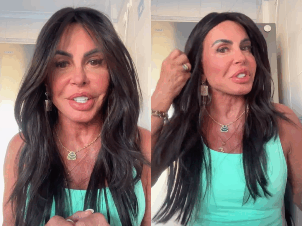 foto-boca-bochecha-e-mandibula-gretchen-exibe-resultado-de-nova-harmonizacao-facial.png
